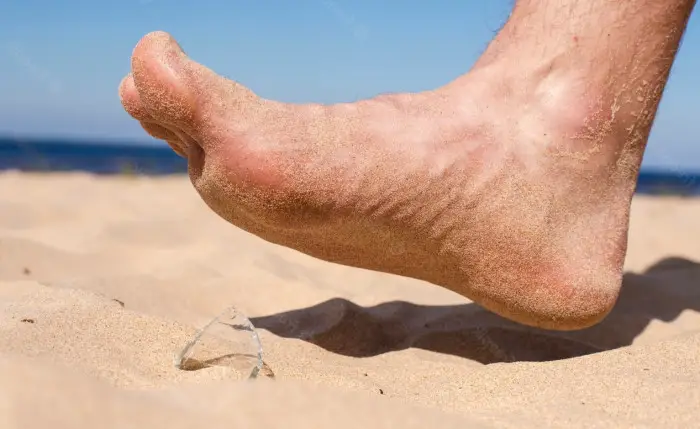 How To Get The Glass Out Of Your Foot